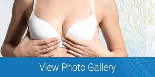 breast augmentation